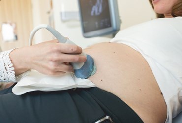 Echo zwangere vrouw geboortecentrum noordlimburg